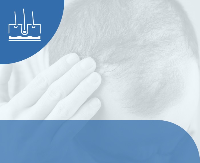 PACCHETTO CADUTA CAPELLI