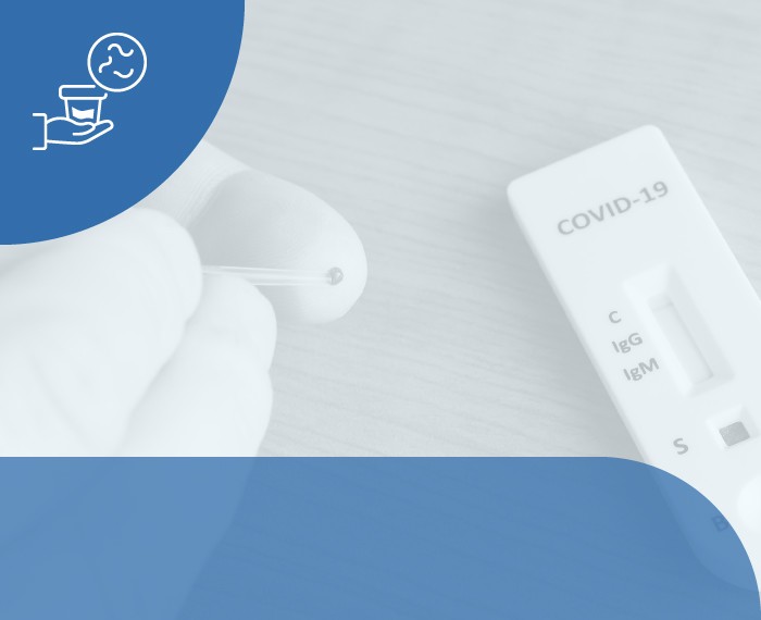 TEST SIEROLOGICO COVID19