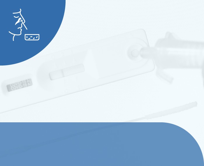TEST MOLECOLARE COVID19